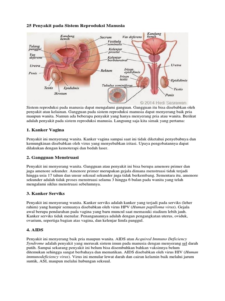 25 Penyakit Pada Sistem Reproduksi Manusia