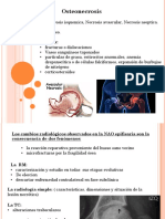 Necrosis Avascular