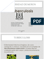 Tuberculosis