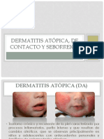 Dermatitis Atopica, de Contacto y Seborreica