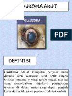 Glaukoma