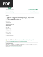 NO 2. Triphasic Computed Tomography (CT) Scan in Focal Tumoral Liver Le-1