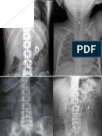 RADIOGRAFIAS