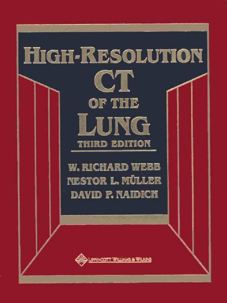 2.High-Resolution CT of The Lung EDITIA A-3-A. | PDF | Ct Scan ...