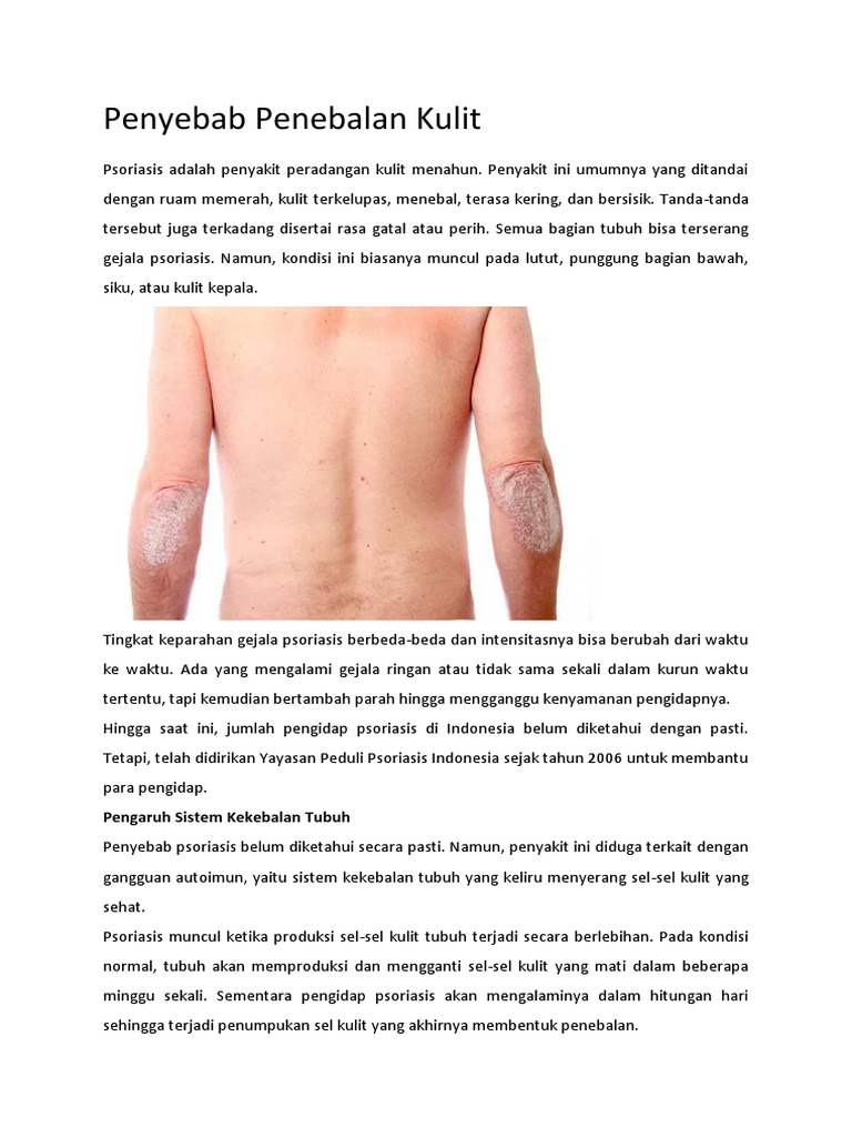 Jaras Sensori Penyebab Penebalan Kulit Dan Penurunan Sensori