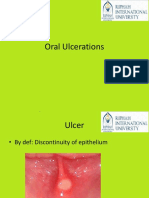 Oral Ulcerations