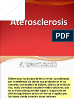 Ate Roe Sclerosis