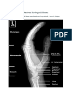 Anatomi Radiografi Manus