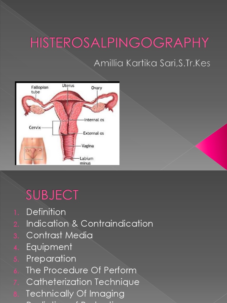 His Tero Salpingo Graphy PDF Medical Imaging Menstruation