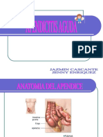 Apendicitis