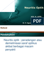 Neuritis 