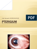 43508400-PTERIGIUM.pptx