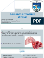Lesiones Alveolares Difusas