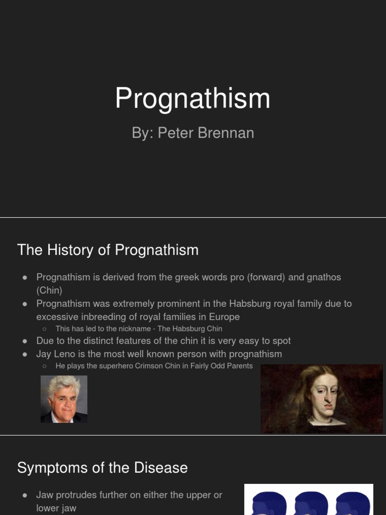 The Habsburg Chin PDF Medical Specialties Medicine