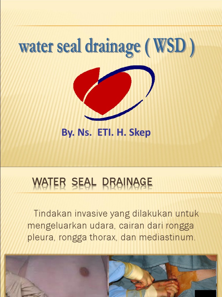 Water Seal Drainage (WSD) PDF