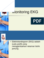 Pemeriksaan EKG