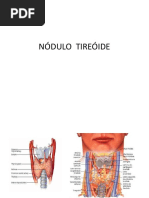 NÓDULO  TIREÓIDE
