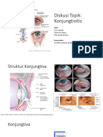 Causes, Symptoms and Treatment of Conjunctivitis