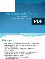 A Fetal Intracranial Tumor