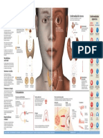 2015 Infografico Hipertiroidismo 