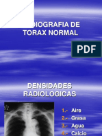 Rx. Normal de Torax