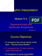 Module4b Supraventricular Arrhythmias