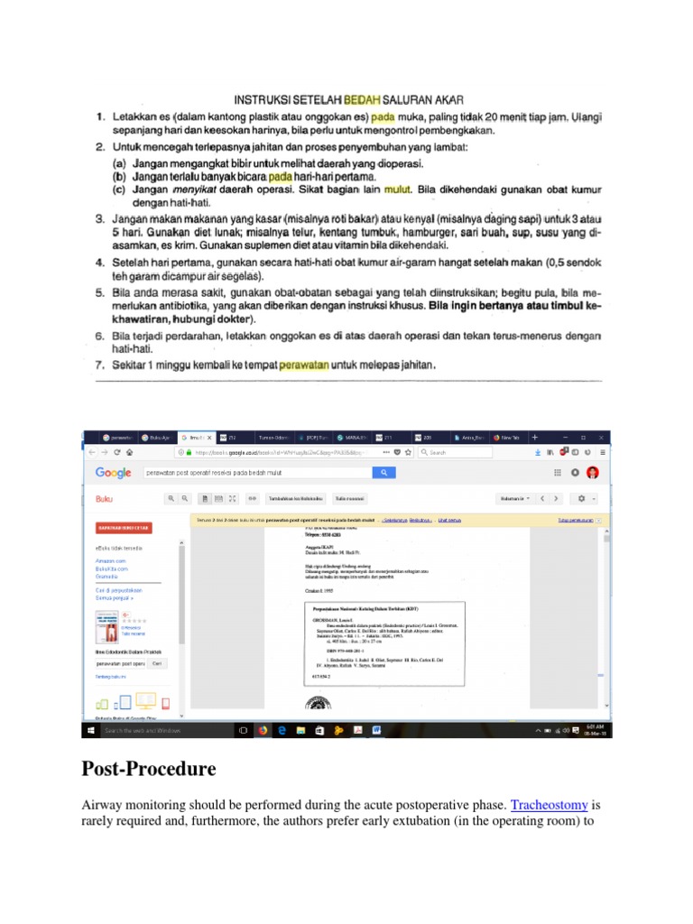 Post | PDF