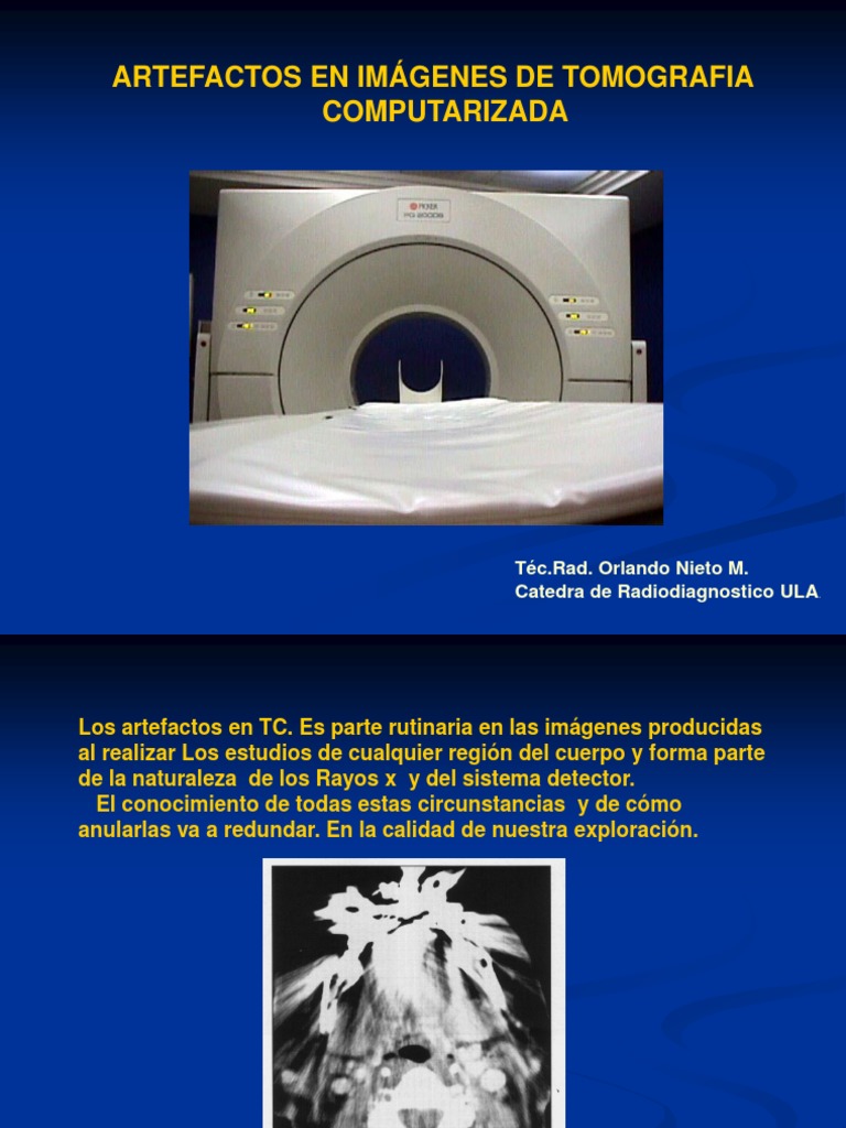 Artefactos En Tac PDF Movimiento f sica Ct Scan
