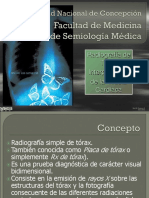 Interpretacion RX Torax Silueta Cardiaca V2