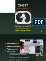 Normal CT Chest