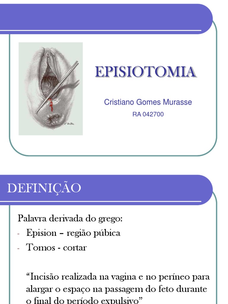 #Apresentação Episiotomia | PDF | Saúde feminina | Remédio