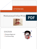 Epistaksis Presentasi