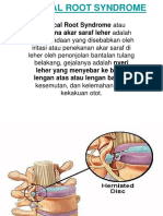 Cervical Root Syndrome