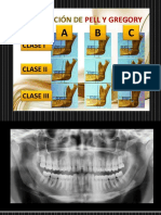 Clasificacion de PyG