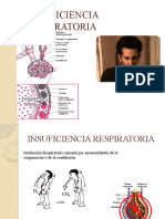 Insuficiencia Respiratoria