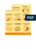 Tipos de Suturas