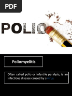 Poliomyelitis