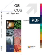 Casos Clinicos en Imagenes CTO.pdf
