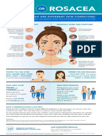Acne or Rosacea Infographic PDF