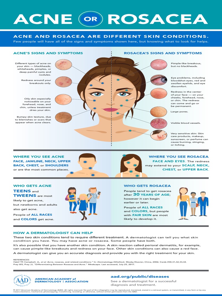 Acne or rosacea infographic pdf pdf dermatology cutaneous conditions