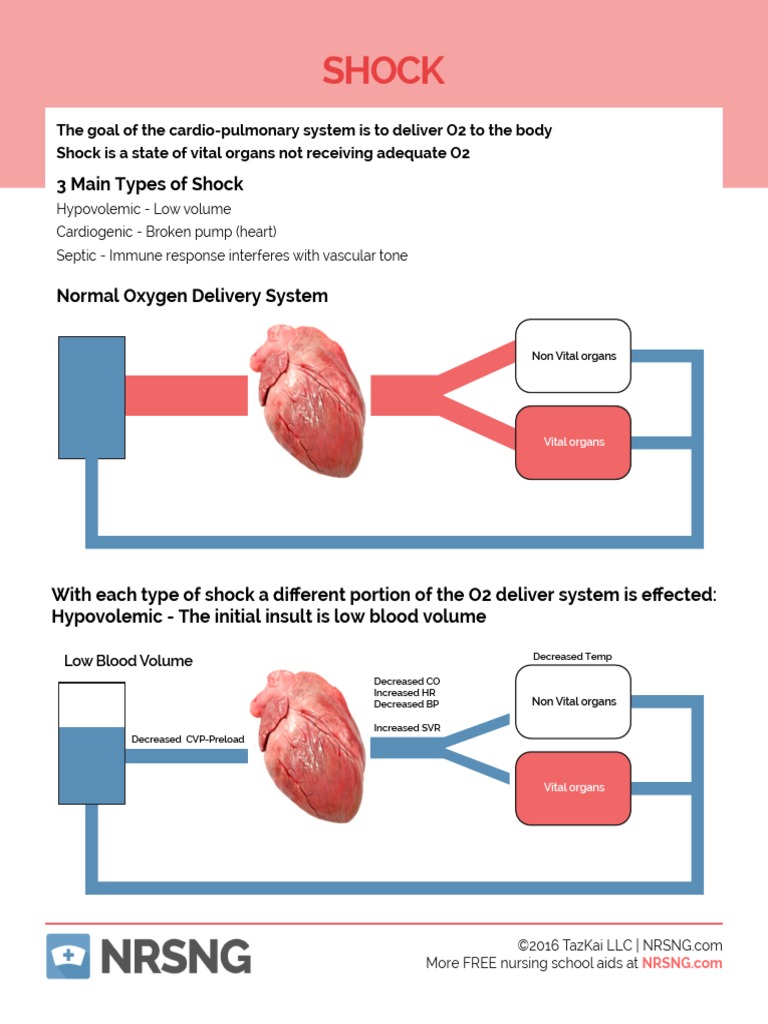 Shock Cheat Sheet.pdf Shock (Circulatory) Physiology