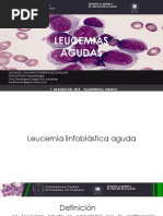 Leucemia linfoblástica aguda