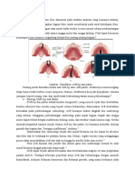 Cleft Lip and Palate