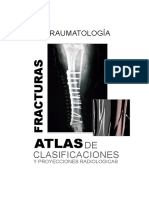 Fracturas del húmero proximal: Clasificación AO