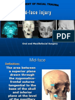 Mid-Face Injury (Trad)