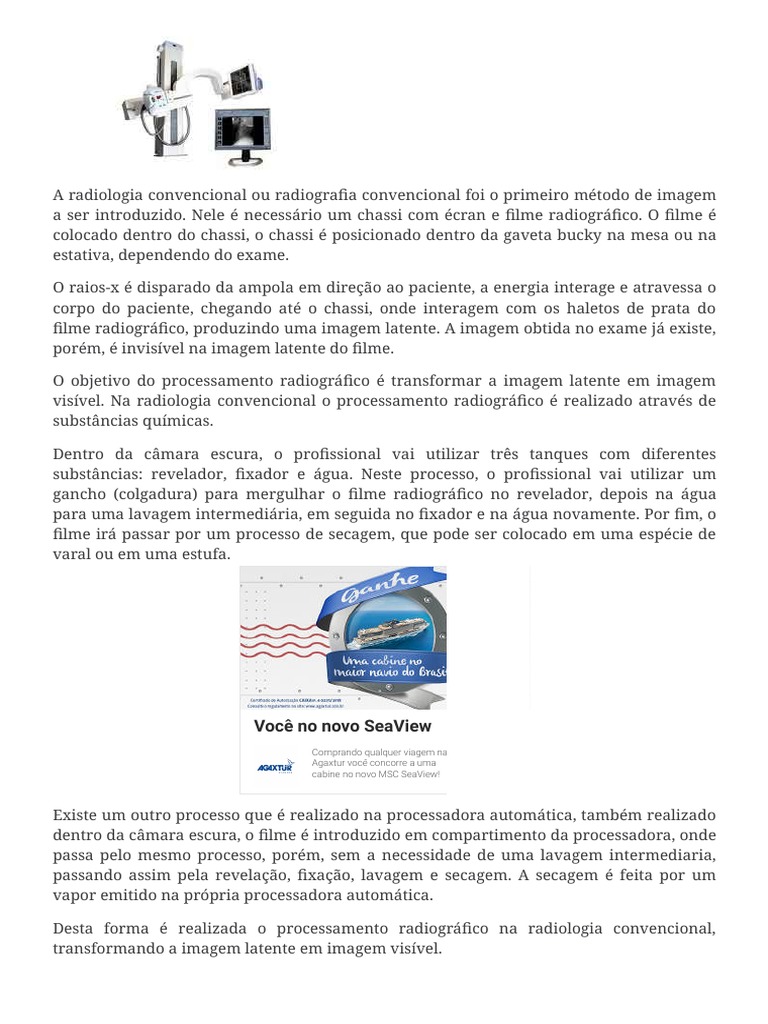 Evolução Dos Processamentos Radiográficos, Saiba Mais Sobre CR e DR ...