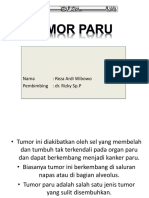 Tumor Paru DR Rizky SP.P