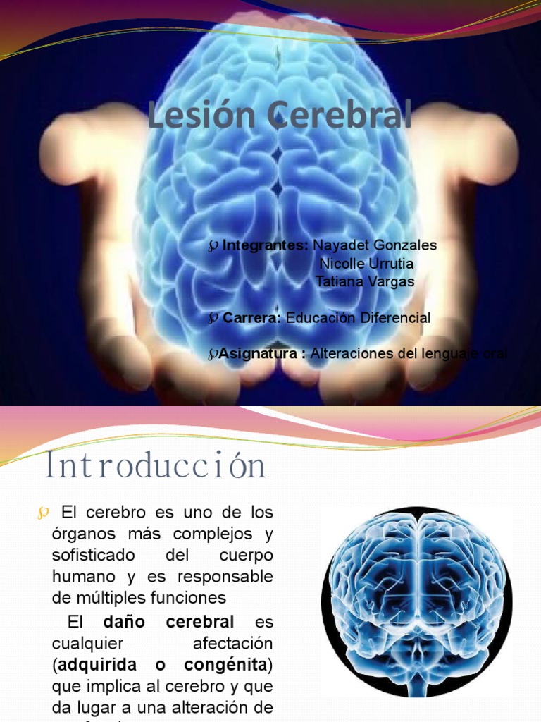 Parálisis Cerebral | Parálisis cerebral | Cerebro