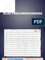 Ekgs