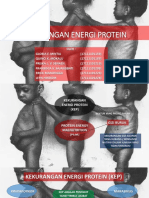 Kekurangan Energi Protein